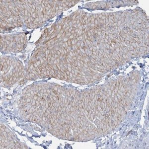 Anti-CUEDC2 antibody produced in rabbit 