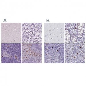 Anti-CXCR2 antibody produced in rabbit 