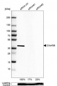 Anti-CXORF38 antibody produced in rabbit 