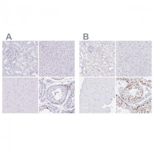 Anti-CXorf67 antibody produced in rabbit 
