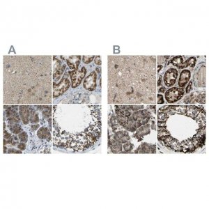 Anti-CYB5R1 antibody produced in rabbit HPA014147-100UL