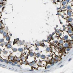 Anti-CYB5R1 antibody produced in rabbit HPA014147-100UL