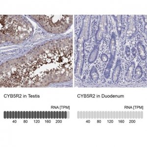 Anti-CYB5R2 