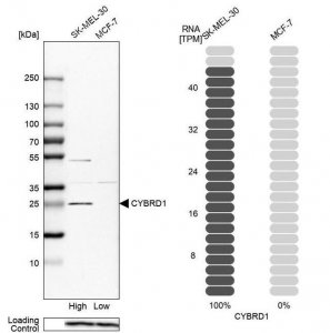 Anti-CYBRD1 antibody produced in rabbit 