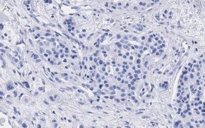 Anti-Cyclin D1 Antibody, clone 1J9, ZooMAb Rabbit Monoclonal 