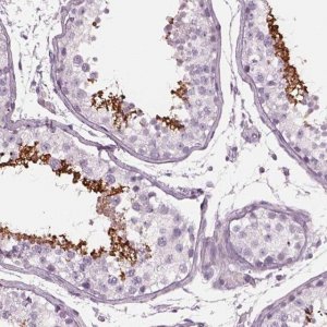 Anti-CYLC1 antibody produced in rabbit 