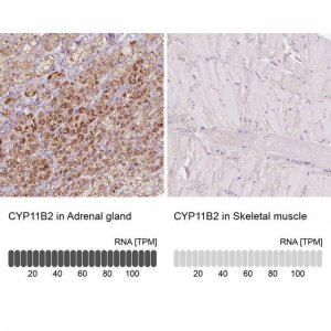 Anti-CYP11B2 antibody produced in rabbit 