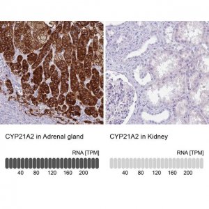 Anti-CYP21A2 antibody produced in rabbit 