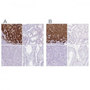 Anti-CYP21A2 antibody produced in rabbit 