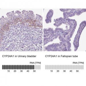 Anti-CYP24A1 antibody produced in rabbit 