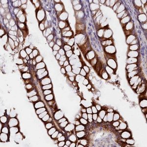 Anti-CYP2D6 antibody produced in rabbit 