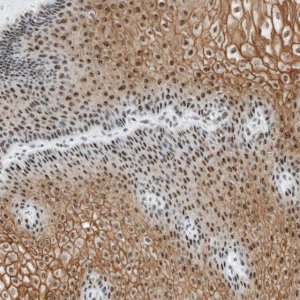 Anti-CYSRT1 antibody produced in rabbit HPA021886-100UL