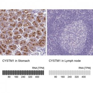 Anti-CYSTM1 antibody produced in rabbit 