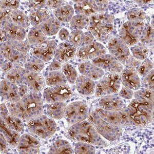 Anti-CYSTM1 antibody produced in rabbit 