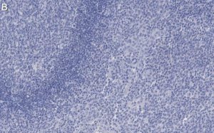 Anti-Cytokeratin 5/6 Antibody, clone D5/16 B4 ZooMAb Mouse Monoclonal 