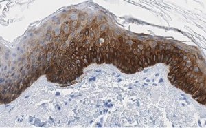 Anti-Cytokeratin-14 Antibody, clone 1D15 ZooMAb Rabbit Monoclonal 
