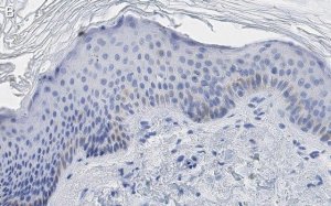 Anti-Cytokeratin-14 Antibody, clone 1D15 ZooMAb Rabbit Monoclonal 