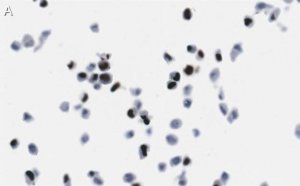 Anti-Cytomegalovirus Antibody, clone 8B1.2 ZooMAb Mouse Monoclonal 