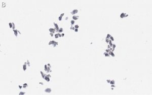 Anti-Cytomegalovirus Antibody, clone 8B1.2 ZooMAb Mouse Monoclonal 