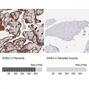 Anti-DAB2 antibody produced in rabbit 