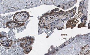 Anti-DAP Kinase 1 Antibody, clone 1J22 ZooMAb Rabbit Monoclonal 