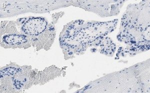 Anti-DAP Kinase 1 Antibody, clone 1J22 ZooMAb Rabbit Monoclonal 