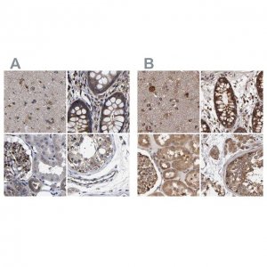Anti-DARS antibody produced in rabbit HPA020451-100UL