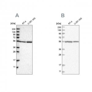 Anti-DARS antibody produced in rabbit HPA020451-100UL