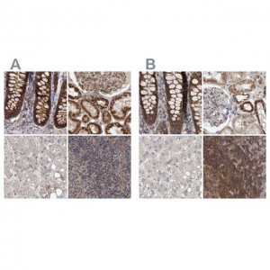 Anti-DARS2 antibody produced in rabbit 