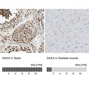Anti-DAXX antibody produced in rabbit 
