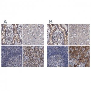 Anti-DBT antibody produced in rabbit 