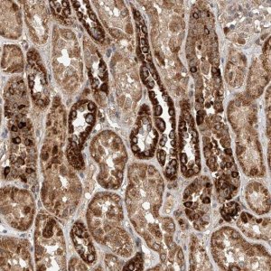 Anti-DCAF11 antibody produced in rabbit 
