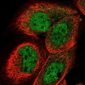 Anti-DCAF11 antibody produced in rabbit 