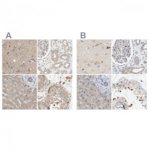 Anti-DCAF7 antibody produced in rabbit 