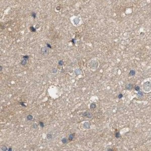 Anti-DCAF7 antibody produced in rabbit 