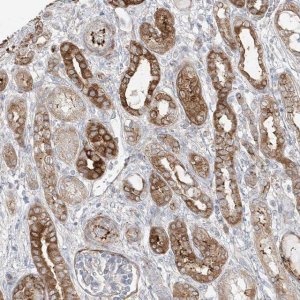 Anti-DCDC2 antibody produced in rabbit 
