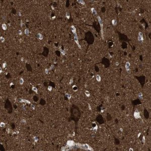 Anti-DCLK1 antibody produced in rabbit 