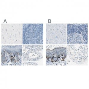 Anti-DCT antibody produced in rabbit 