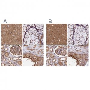 Anti-DCTN2 antibody produced in rabbit HPA039715-100UL