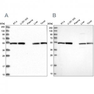 Anti-DCTN2 antibody produced in rabbit HPA039715-100UL