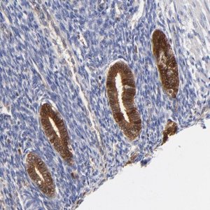 Anti-DCTPP1 antibody produced in rabbit 