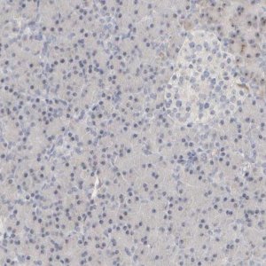 Anti-DCXR antibody produced in rabbit 