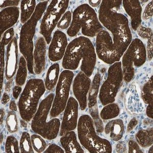 Anti-DDAH1 antibody produced in rabbit 