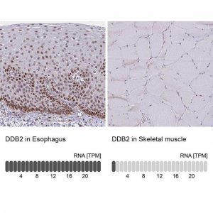 Anti-DDB2 antibody produced in rabbit 
