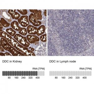 Anti-DDC antibody produced in rabbit HPA017742-100UL