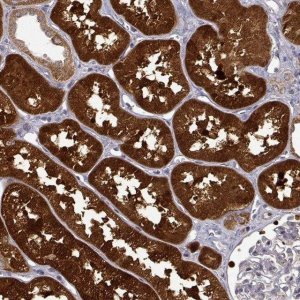 Anti-DDC antibody produced in rabbit HPA017742-100UL