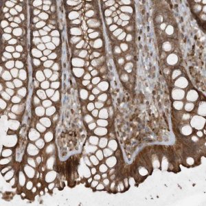Anti-DDIT4 antibody produced in rabbit 