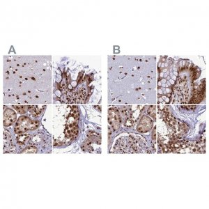 Anti-DDX1 antibody produced in rabbit 