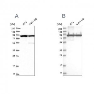 Anti-DDX1 antibody produced in rabbit 