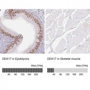 Anti-DDX17 antibody produced in rabbit 